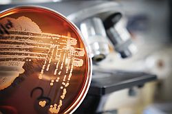 Effektives mikrobiologisches Umgebungsmonitoring für nichtsterile Arzneimittel