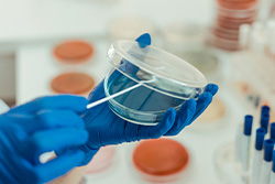 Risk Assessment (RA)* - ein vielfach ungenutztes Instrument zur Beurteilung von mikrobiologischen Befunden in der Pharmazeutischen Industrie – Teil 1